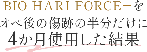 BIO HARI FORCE＋をオペ後の傷跡の半分だけに4か月使用した結果