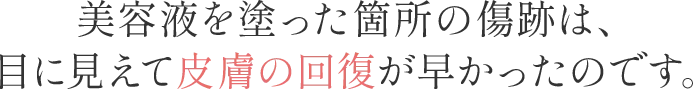 美容液を塗った箇所の傷跡は、目に見えて皮膚の回復が早かったのです。